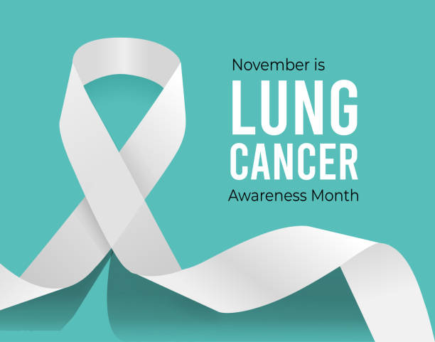 What you need to know about lung cancer